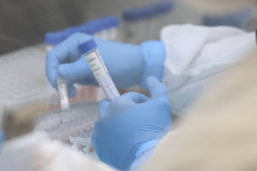 Casos confirmados de Covid-19 ultrapassam um milhão no Paraná