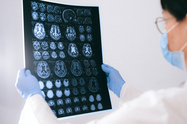 14 de abril é o Dia do Neurocirurgião